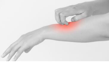 辉瑞宣布湿疹药物阿布罗替尼通过第二阶段三期试验 ,stylechina.com