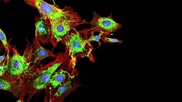 MacroGenics的转移性乳腺癌药物在第三阶段试验中显示出生存优势 ,stylechina.com