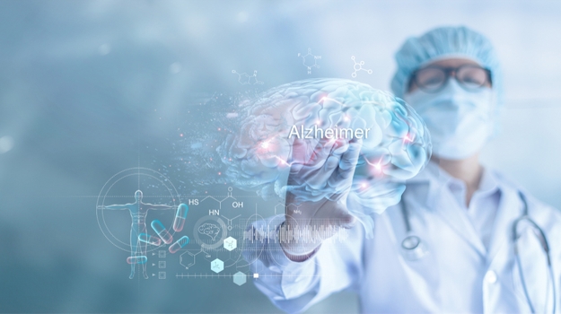 0012fb92-800.webp.jpg 研究发现可能赋予抵抗阿尔茨海默氏病的基因变异 ,stylechina.com