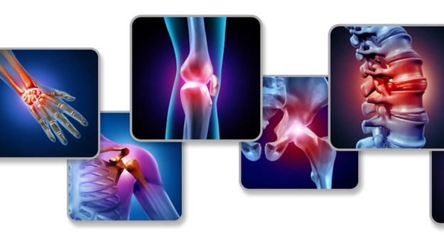 ACR年会：Janssen的Tremfya钉住了24周银屑病关节炎研究的主要终点 ,stylechina.com