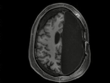 大脑如何重新连线自己大脑的如何重新连线自己 ,stylechina.com
