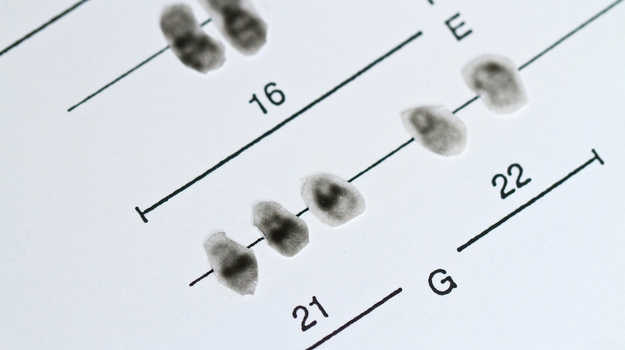 研究综述：唐氏综合症的记忆途径等 ,stylechina.com