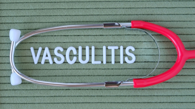 ChemoCentryx药物在III期血管炎试验中达到共同终点 ,stylechina.com