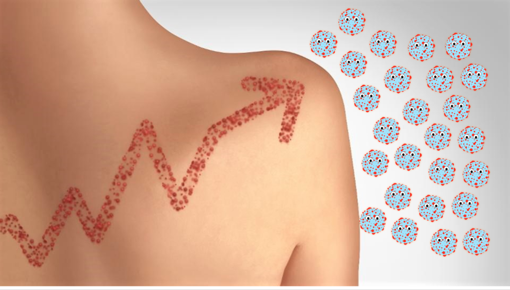 全球麻疹病例激增，比去年增加26％ ,stylechina.com