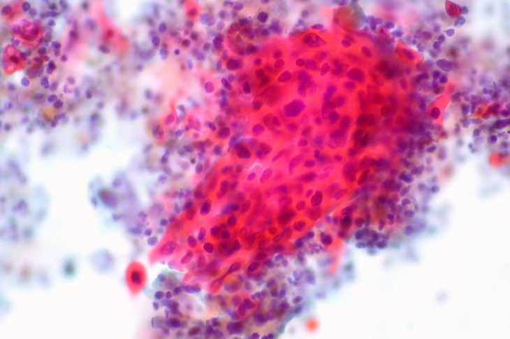  Trialjectory使用自我报告的临床数据将癌症患者与临床试验相匹配 ,stylechina.com