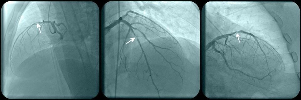 研究发现，美国近50％的成年人没有意识到心脏病发作的某些症状 ,stylechina.com