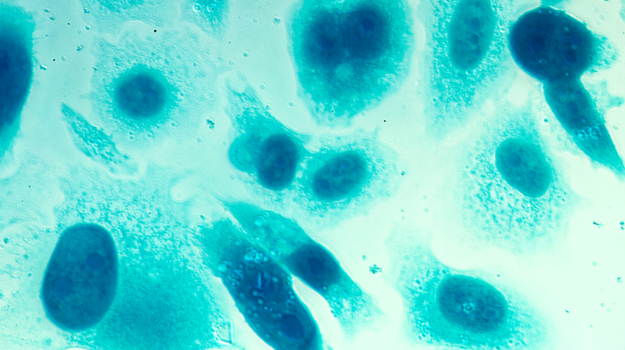 Progenics计划在第三阶段结果后寻求批准使用前列腺癌成像工具 ,stylechina.com