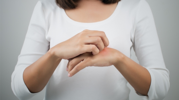 分析师预测，特应性皮炎的空间将在2020年升温 ,stylechina.com