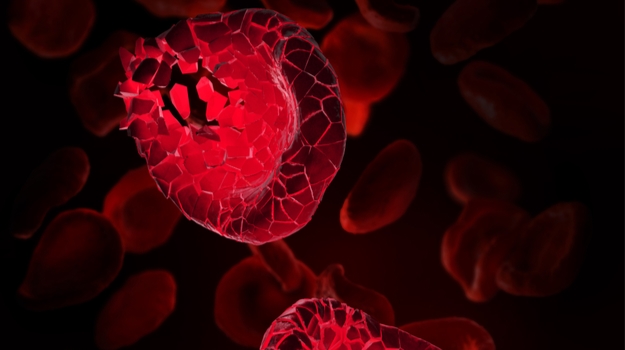 00134d40-800.webp.jpg Apellis的PNH药物在第三阶段试验中击败了Alexion的Soliris ,stylechina.com