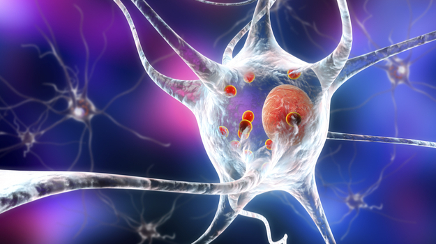 新分子具有阻止或减慢帕金森氏症的潜力 ,stylechina.com