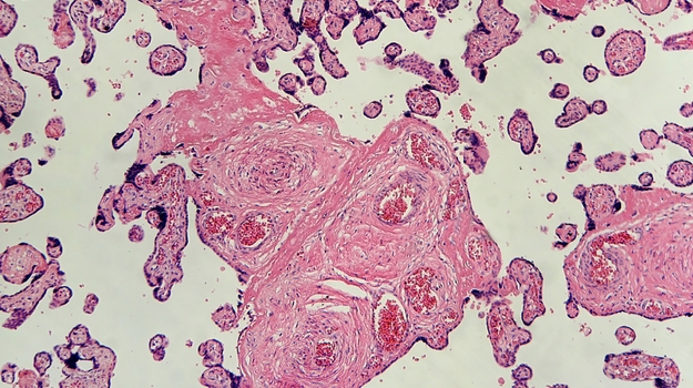 Pluristem促进胎盘细胞调节COVID-19细胞因子风暴 ,stylechina.com