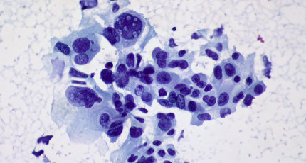 aerialcontext.jpg 由NEA支持的Personal Genome Diagnostics因其癌症诊断而获得FDA批准 ,stylechina.com