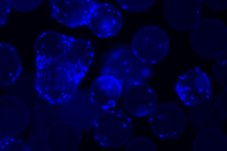 中胚层干细胞治疗COVID-19的临床试验即将开始 ,stylechina.com