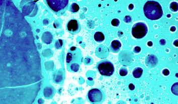 赛诺菲和再生元的Libtayo在基础细胞癌中获益 ,stylechina.com