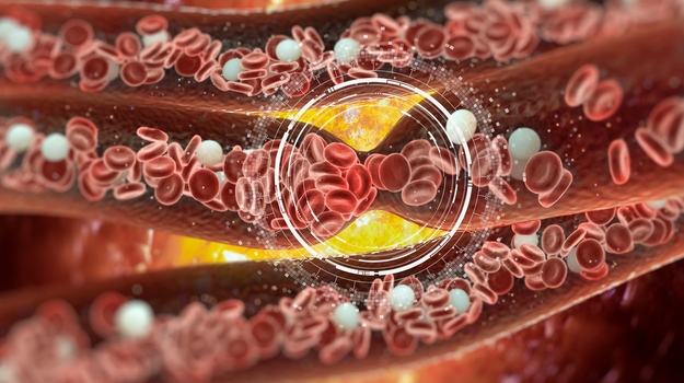 研究：抗凝剂可能是预防COVID-19患者血栓的关键 ,stylechina.com