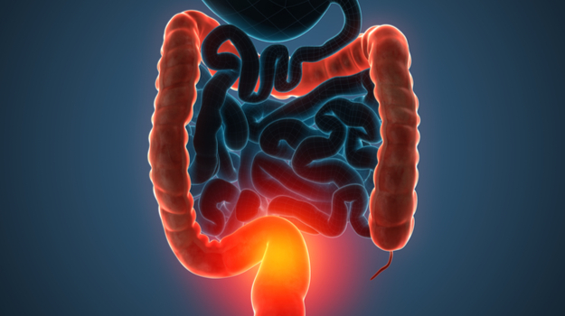 BMS最近批准的MS药物在溃疡性结肠炎研究中显示出了希望 ,stylechina.com