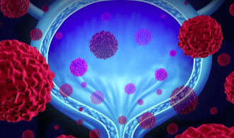 默克公司的Keytruda在一线膀胱癌治疗试验中未能达到目标 ,stylechina.com