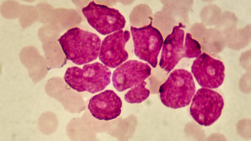 AbbVie的Venclexta和化学组合可将AML的死亡率降低34% ,stylechina.com