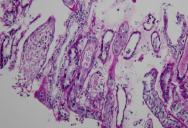 COVID-19肾脏活检研究表明，大部分肾小管损伤且组织中不存在病毒 中网时尚,stylechina.com