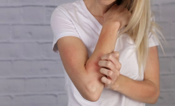 艾伯维（AbbVie）的Rinvoq在关键的III期皮肤炎试验中大获成功 中网时尚,stylechina.com