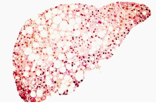 GENFIT废除NASH的Elafibranor，设定新的战略重点 中网时尚,stylechina.com