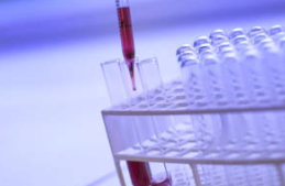 许多人希望COVID-19抗体测试能够帮助企业和机构安全地重新营业 中网时尚,stylechina.com