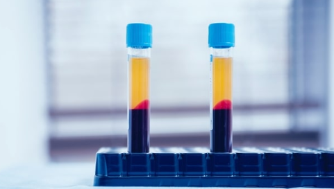 大量研究表明，恢复性抗体可能有助于治疗COVID-19 中网时尚,stylechina.com