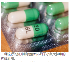 氟西汀诱导海马中血清素能纤维的形态重排  中网时尚,stylechina.com