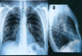 这样它不仅可以作为筛查COVID征象的手段研究人员在一份新报告中说 中网时尚,stylechina.com