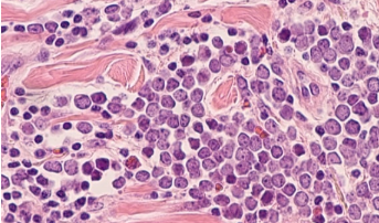 ALX Oncology在HNSCC研究中将主要资产与Keytruda配对 中网时尚,stylechina.com