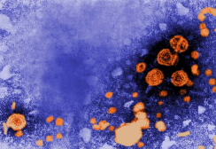 肝载脂蛋白AI改变的模式与男性慢性乙型肝炎的进展有关 中网时尚,stylechina.com