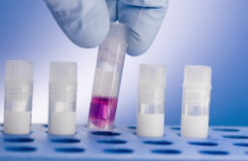 蛋白质组学翻译：您能为真正的患者做什么？ 中网时尚,stylechina.com