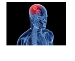 甲氨蝶呤经鼻向大鼠脑肿瘤的递送：脑肿瘤化学疗法的新策略 中网时尚,stylechina.com