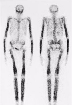 同位素是用于诊断和治疗各种疾病的微量放射性物质 中网时尚,stylechina.com