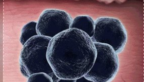 生物共轭金纳米笼靶向的黑素瘤的体内分子光声层析成像 中网时尚,stylechina.com