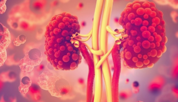 积极的后期研究结果表明，Calliditas批准了IgaN治疗 中网时尚,stylechina.com