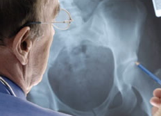 双相情感障碍和其他疾病的药物后可能发生的骨质流失的可能解释 中网时尚,stylechina.com