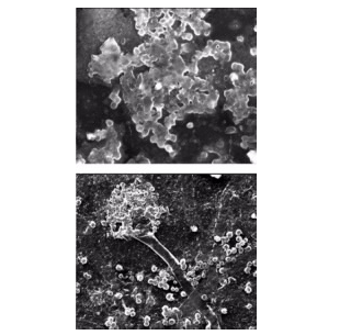 真菌对经理化处理的聚碳酸酯进行的生物降解 中网时尚,stylechina.com