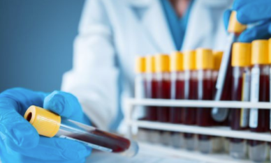 研究综述:严重COVID-19等血液测试 中网时尚,stylechina.com