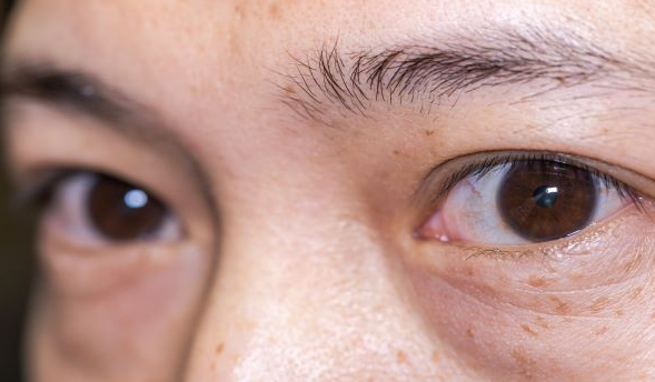 Genentech可以通过新疗法重新夺回与失明有关的疾病市场 中网时尚,stylechina.com