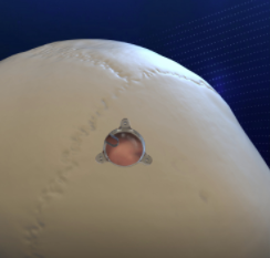 Longeviti推出ClearFit保护套，可为脑外科手术患者进行术后超声成像 中网时尚,stylechina.com