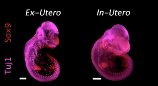 Nature:人造机器子宫!以色列科学家首次在人造子宫中培养哺乳动物胚胎 中网时尚,stylechina.com