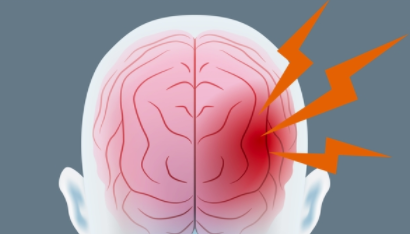 橄榄球运动员的脑震荡研究可能导致更广泛人群的损伤点诊断 中网时尚,stylechina.com
