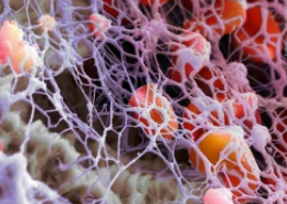 胶原蛋白和纤维蛋白原等纤维蛋白在水溶液表面形成一层薄的固体层 中网时尚,stylechina.com