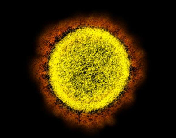 从患者分离出的SARS-CoV-2病毒颗粒的新型冠状病毒SARS-CoV-2透射电子显微照片 中网时尚,stylechina.com