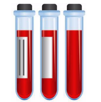 利用循环吞噬细胞的化学发光特征区分病毒和细菌急性感染 中网时尚,stylechina.com