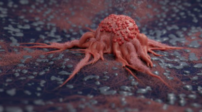 Nanobiotix 的肿瘤放射治疗增强剂还可以启动免疫系统 中网时尚,stylechina.com