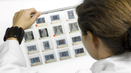 癌症如何欺骗免疫系统发展疾病 中网时尚,stylechina.com