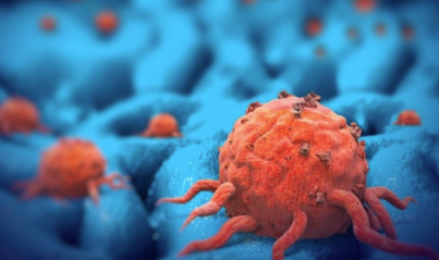 U Minnesota Research 的肿瘤 T 细胞治疗的下一个目标 中网时尚,stylechina.com