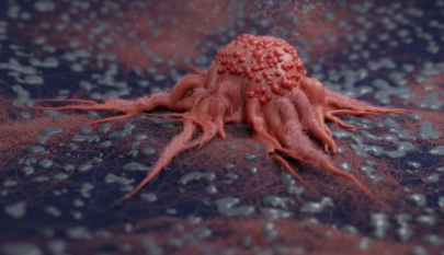 Wugen 筹集 1.72 亿美元，为实体瘤带来自然杀伤疗法 中网时尚,stylechina.com